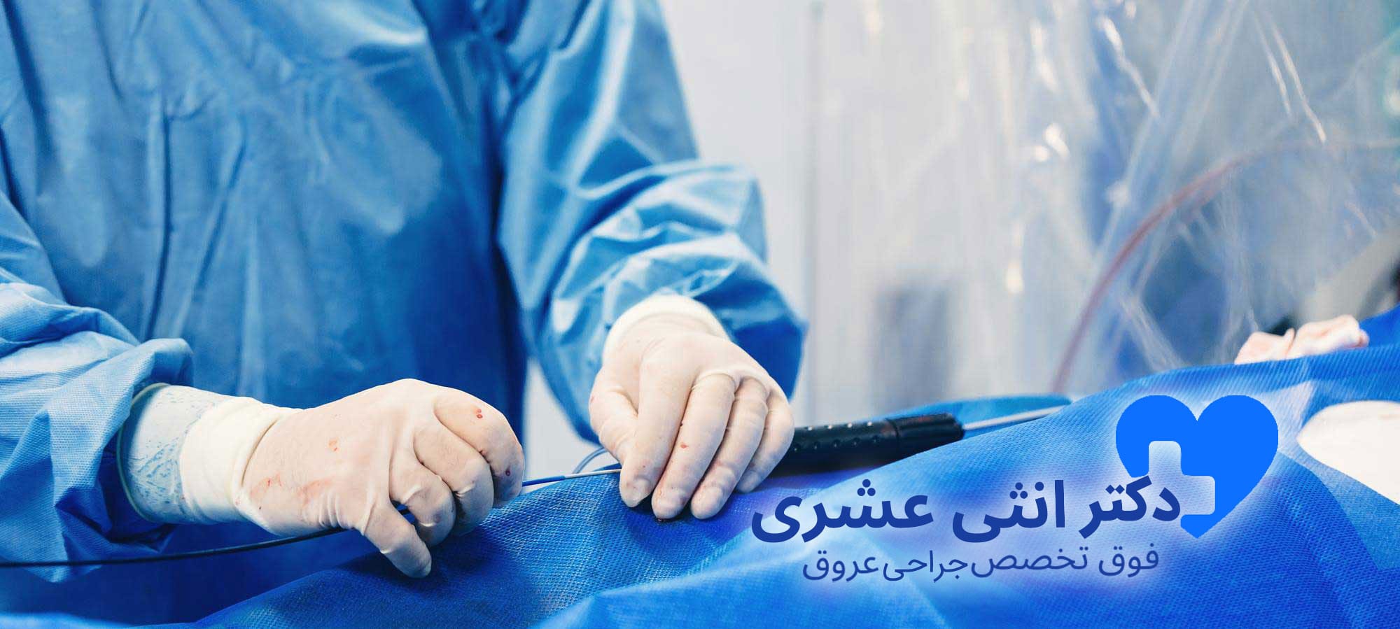 آنژیوپلاستی عروق محیطی